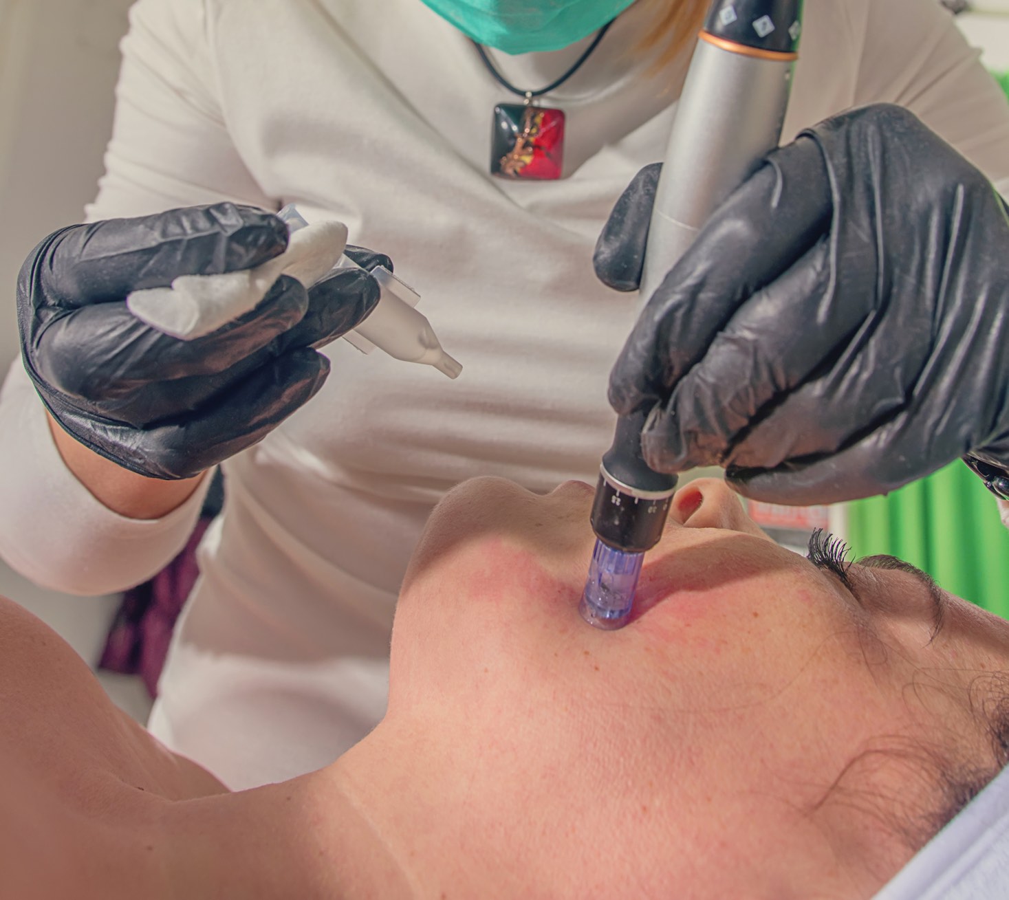 Blood Cream Products