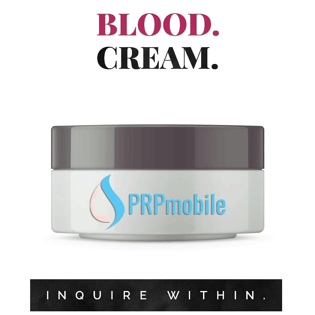 Trigger Point Injections